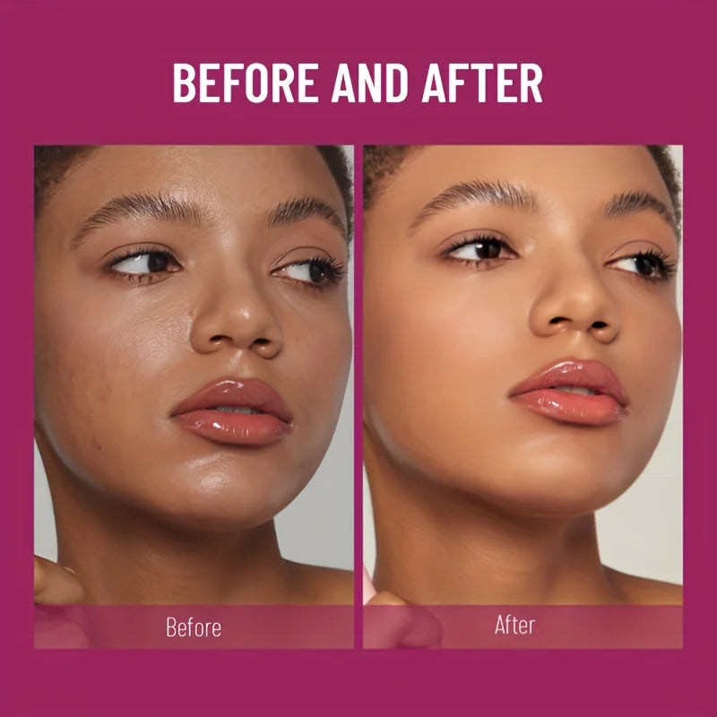 π§½ New Sponge-Head Concealer β Say Goodbye to Dark Circles, Freckles, Acne & Pigmentation Instantly