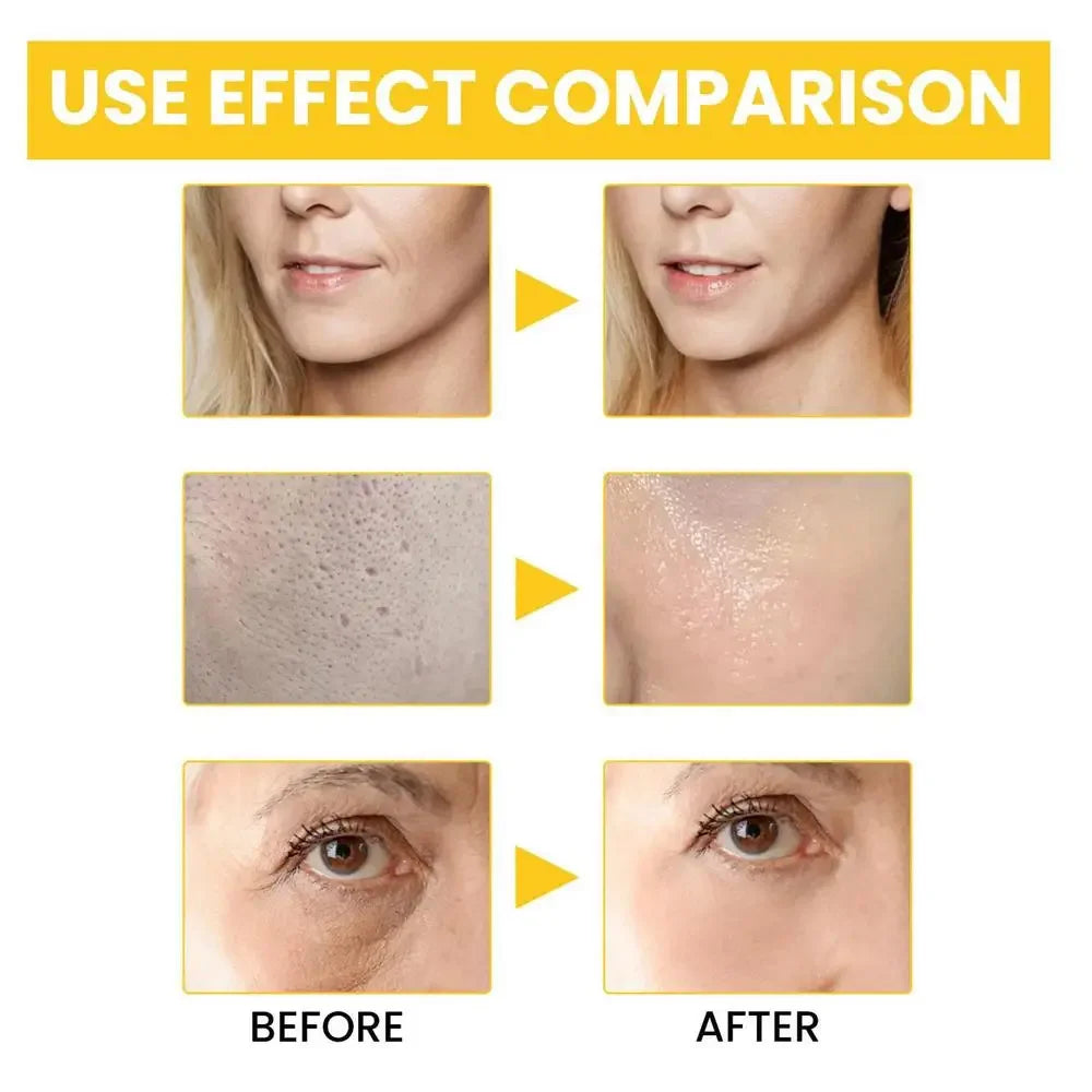 Retinol Hyaluronic Acid Serum